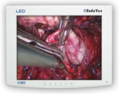 NDS Surgical Imaging EndoVue HD LED 15" Monitor 